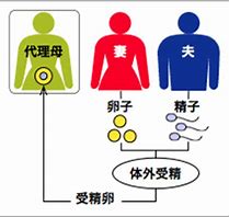 丸岡いずみロシア代理母出産費用と子供の戸籍や国籍はどうなる 誰かに話したくなる旬の話題